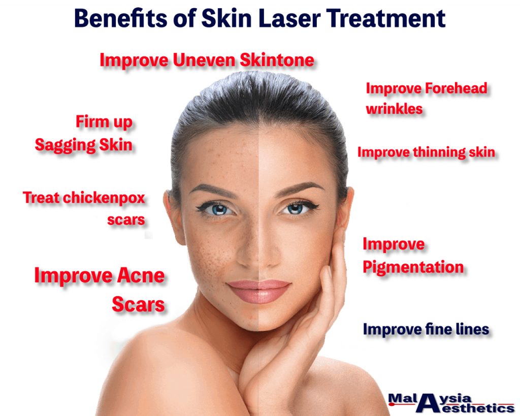 Skin Laser Malaysia, Pigmentation Laser in Malaysia - Malaysia Aesthetic